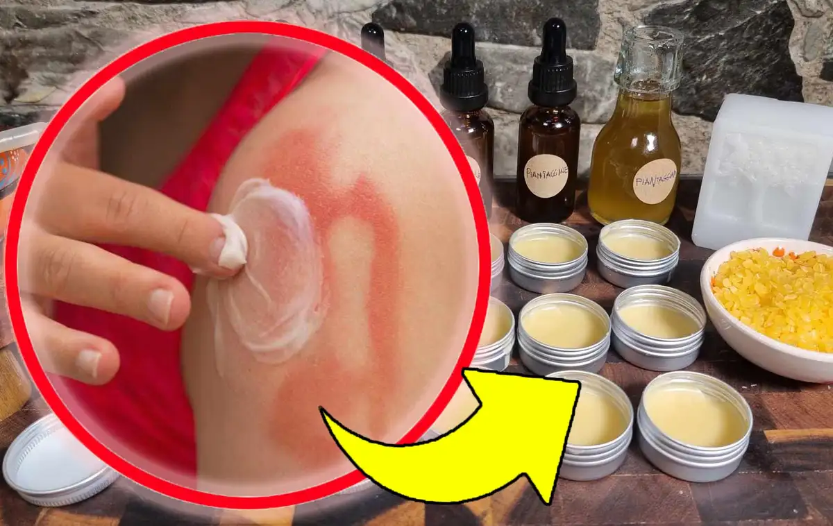 Grandma's Secret: The Ultimate Remedy For Skin Irritations!